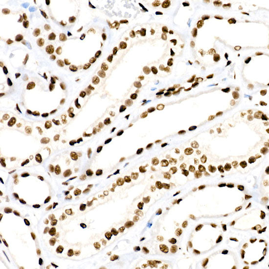 RBBP5 Rabbit mAb