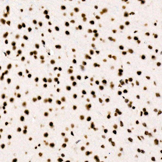 RBBP5 Rabbit mAb