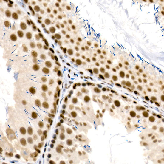 RBBP5 Rabbit mAb