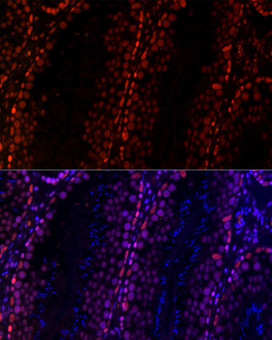 RBBP5 Rabbit mAb