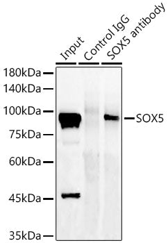 SOX5 Rabbit mAb