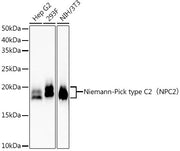 Niemann-Pick type C2（NPC2） Rabbit mAb