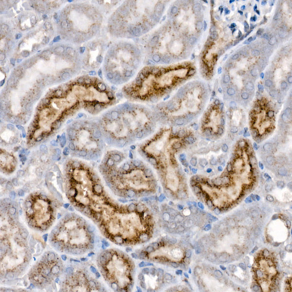 Niemann-Pick type C2（NPC2） Rabbit mAb