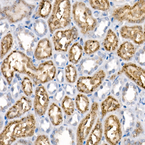 Niemann-Pick type C2（NPC2） Rabbit mAb
