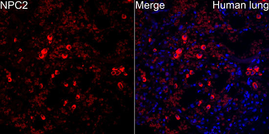 Niemann-Pick type C2（NPC2） Rabbit mAb