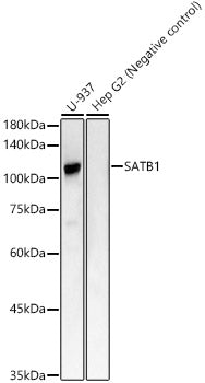 SATB1 Rabbit mAb