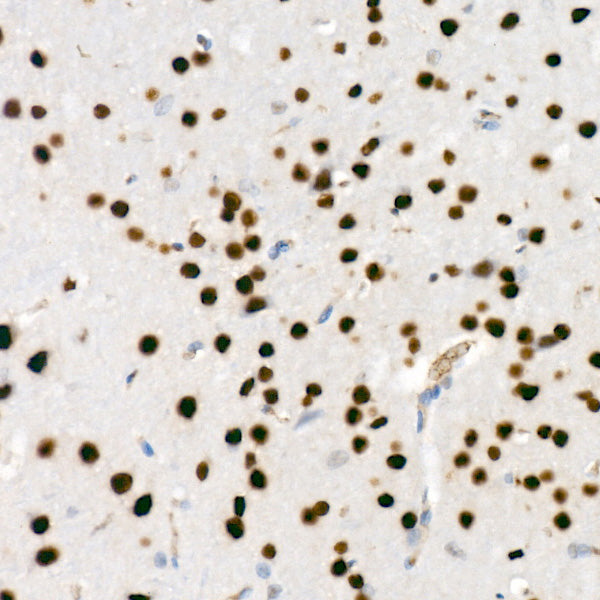 SATB1 Rabbit mAb