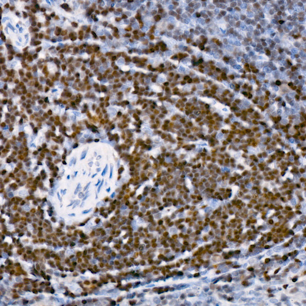 SATB1 Rabbit mAb