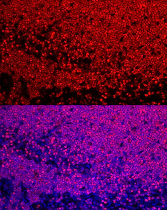 SATB1 Rabbit mAb