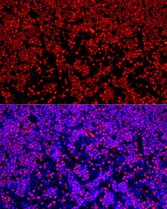SATB1 Rabbit mAb