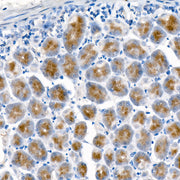 Pepsinogen I (PG I) Rabbit mAb