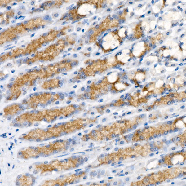 Pepsinogen I (PG I) Rabbit mAb
