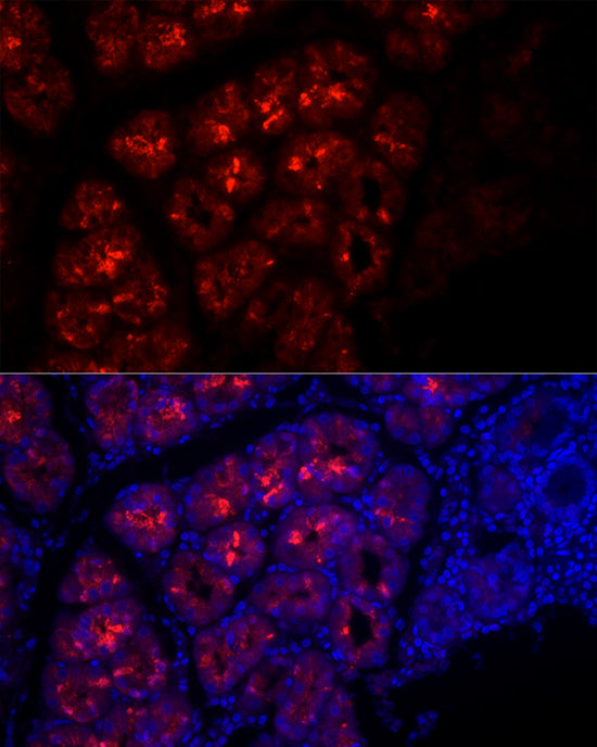 Pepsinogen I (PG I) Rabbit mAb