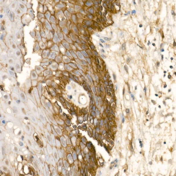 ASCT2/SLC1A5 Rabbit mAb
