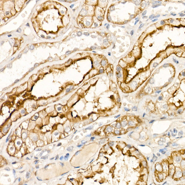 ASCT2/SLC1A5 Rabbit mAb