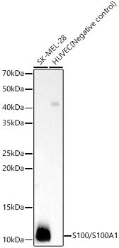 S100/S100A1 Rabbit mAb