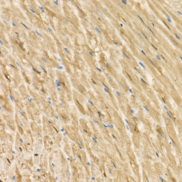S100/S100A1 Rabbit mAb