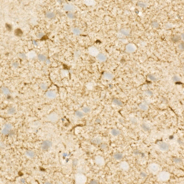 S100/S100A1 Rabbit mAb