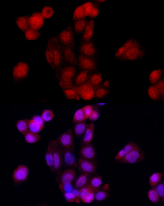 S100/S100A1 Rabbit mAb