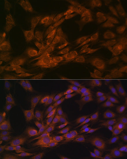 Nogo Rabbit mAb