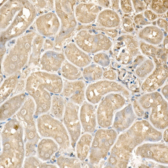 FCGRT/FCRN Rabbit mAb