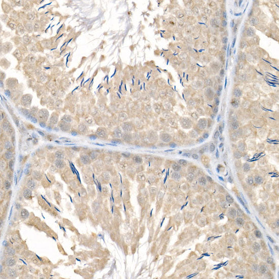 FCGRT/FCRN Rabbit mAb