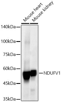 NDUFV1 Rabbit mAb