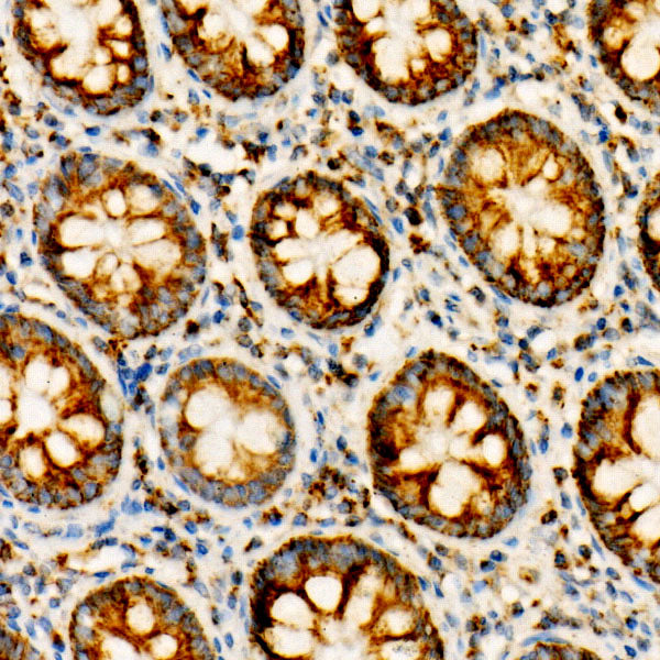 NDUFV1 Rabbit mAb