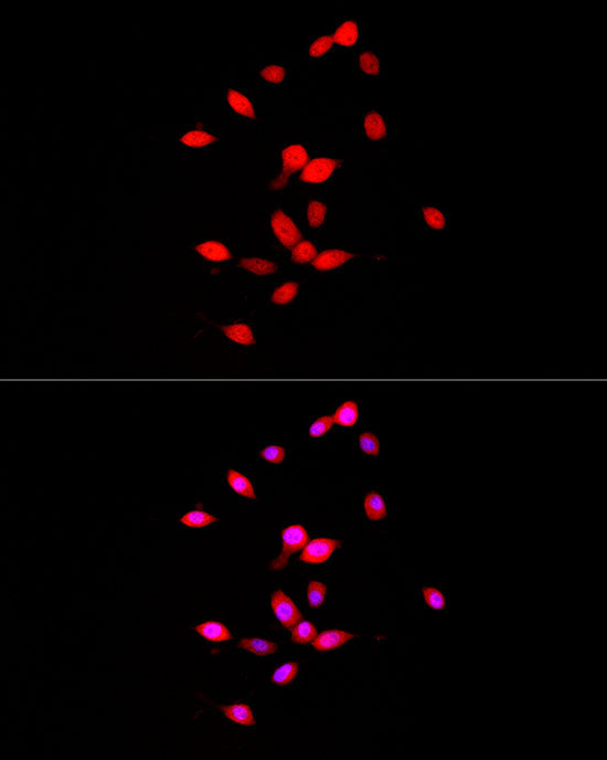 FGF1 Rabbit mAb