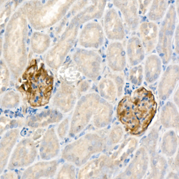 Nephrin Rabbit mAb