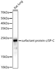 SFTPC Rabbit mAb