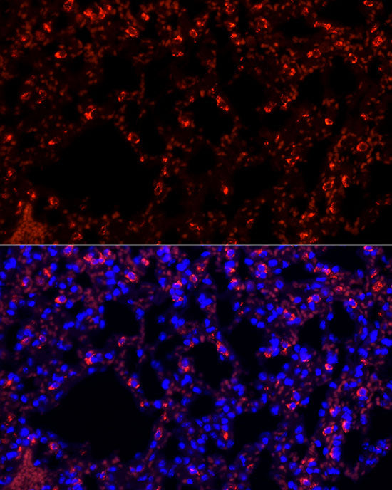 SFTPC Rabbit mAb