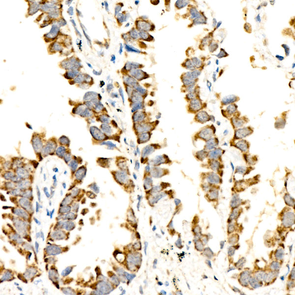 ATAD3A/B Rabbit mAb
