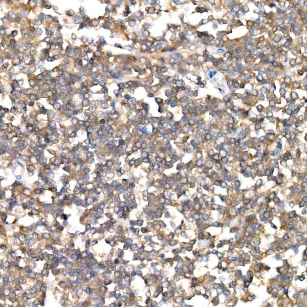 [KD Validated] NF2/Merlin Rabbit mAb