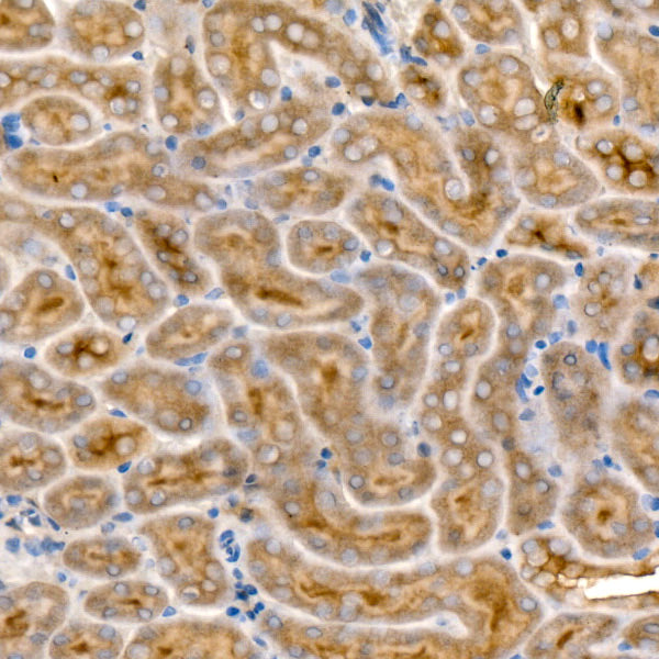 [KD Validated] NF2/Merlin Rabbit mAb