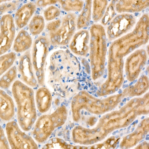 [KD Validated] NF2/Merlin Rabbit mAb