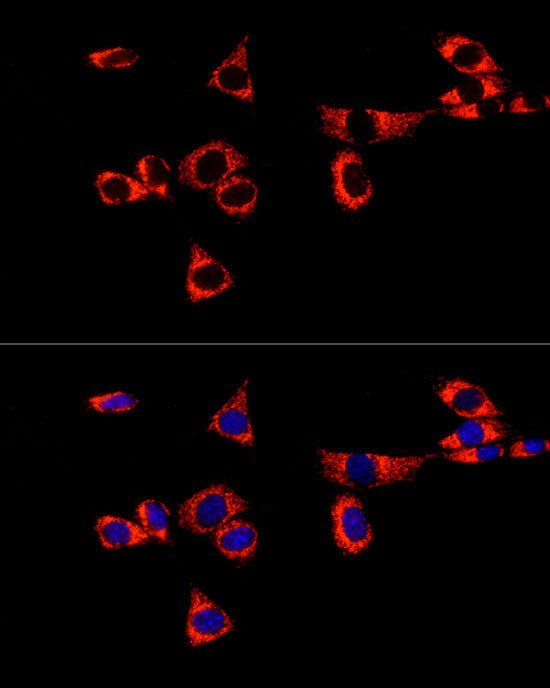 Glutaminase (GLS) Rabbit mAb