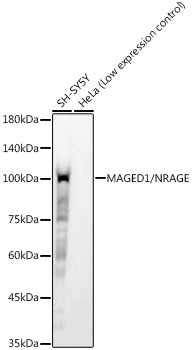 MAGED1/NRAGE Rabbit mAb