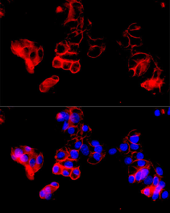 CD98/SLC3A2 Rabbit mAb