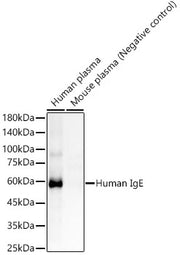 Human IgE Rabbit mAb