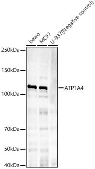 ATP1A4 Rabbit mAb