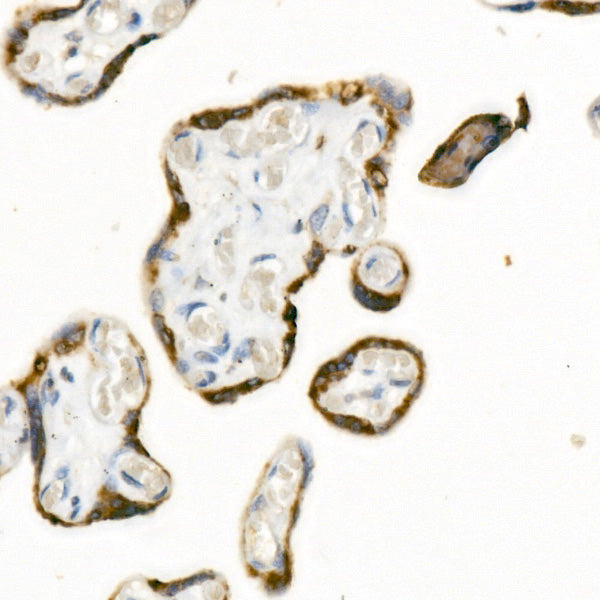 ATP1A4 Rabbit mAb