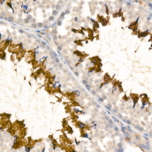ATP1A4 Rabbit mAb