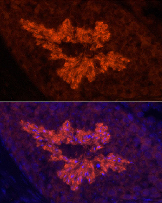 ATP1A4 Rabbit mAb