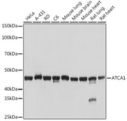 α-Actin-1 (ACTA1) Rabbit mAb