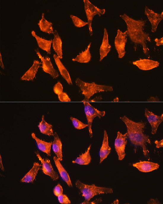 α-Actin-1 (ACTA1) Rabbit mAb