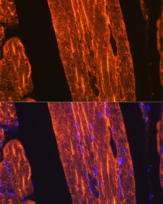 α-Actin-1 (ACTA1) Rabbit mAb