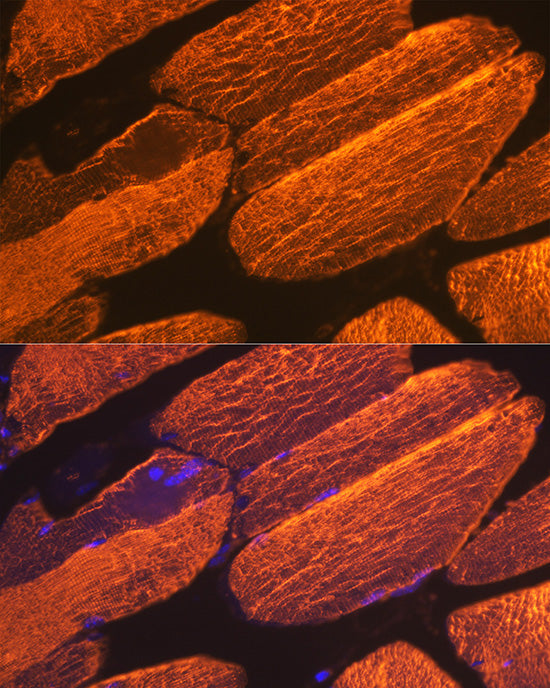 α-Actin-1 (ACTA1) Rabbit mAb