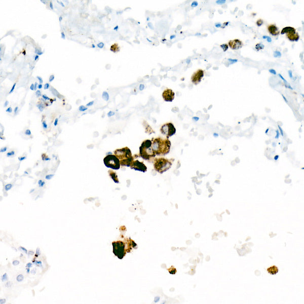 CD68 Rabbit mAb
