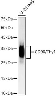[KD Validated] CD90/Thy1 Rabbit mAb